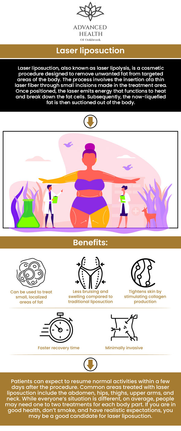 Laser lipolysis is a non-invasive method of body contouring. It gets rid of tiny fat deposits. This technique, like surgical liposuction, destroys fat cells from your body permanently. It is significantly less painful, and the healing time for laser lipolysis is also lower and less complicated. Dr. Christopher Orenczak at Advanced Health of Oakbrook offers laser lipo treatment to those who want to enhance their body's aesthetic attractiveness with the reduction of unwanted fat. For more information, contact us today or schedule an appointment online. Visit our clinic conveniently located at 17W705 Butterfield Road Suite E, Oakbrook Terrace, IL 60181.