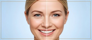 Revitalize Your Skin: How Opus Plasma Reduces Fine Lines by Stimulating Collagen | Advanced Health of Oakbrook