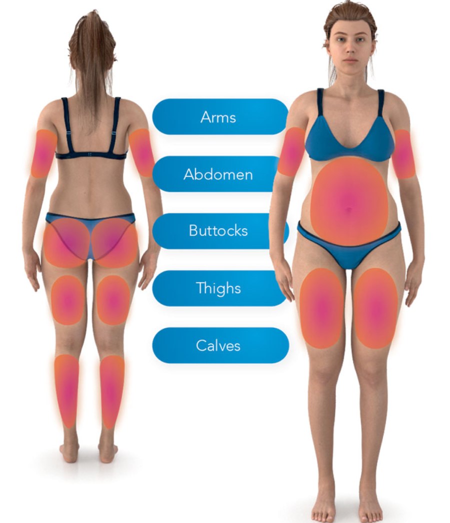 EmSlim Treatment Specialist in Oakbrook Terrace, IL
